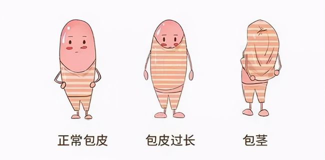 儿童包皮一定要切吗,齐齐哈尔附大男科线上买球官网(中国)官方网站
